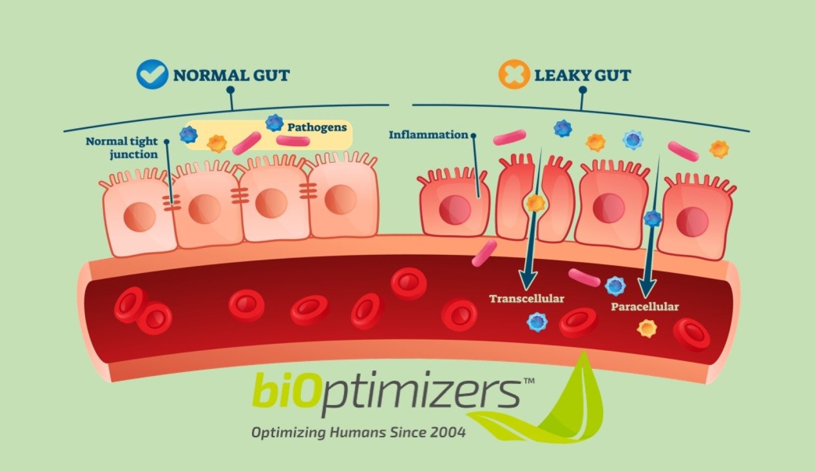 Leaky Gut Syndrome