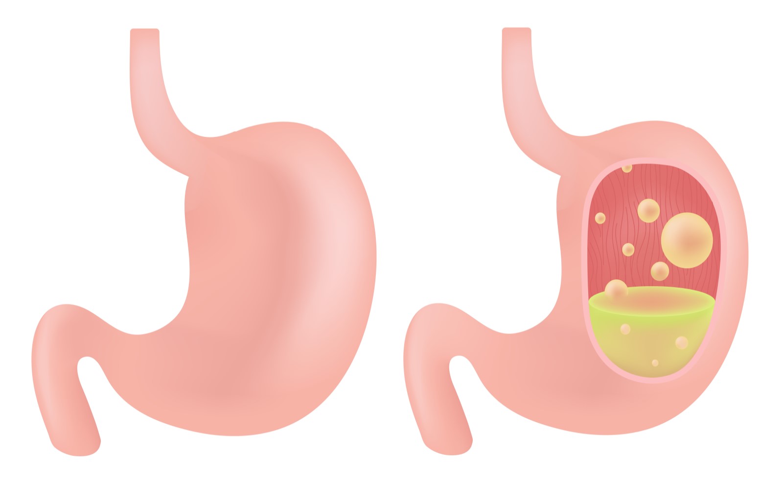 Digestive Enzymes For Bloating And Gas - BiOptimizers