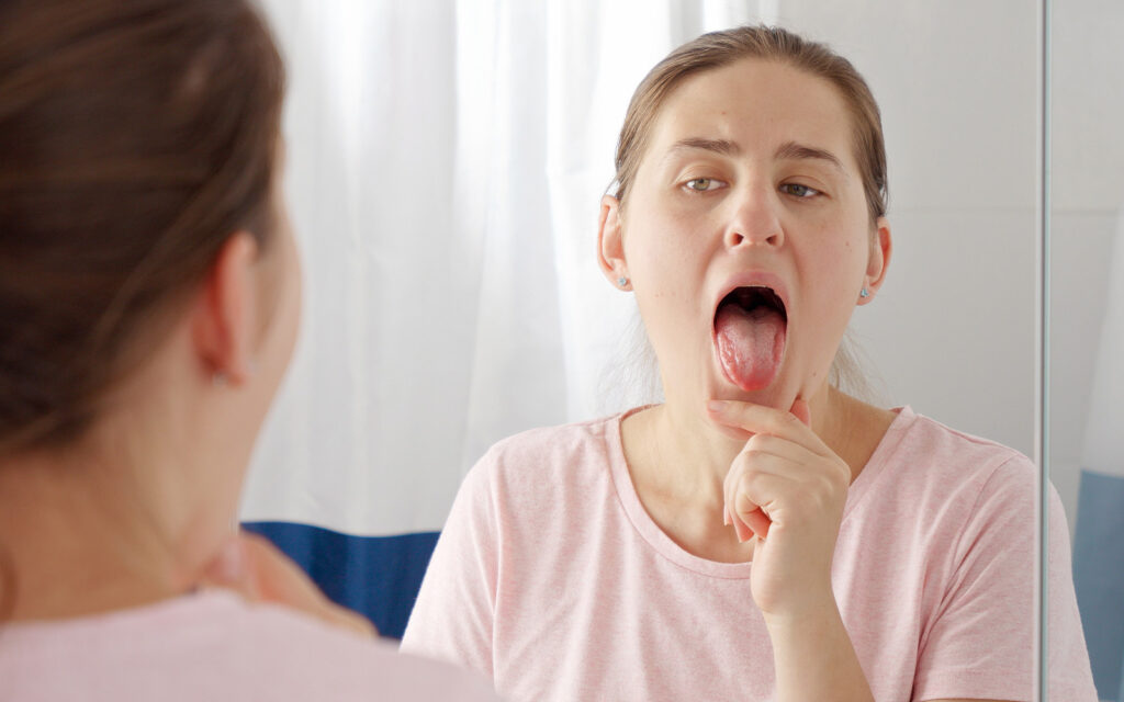 open mouth tongue mirror